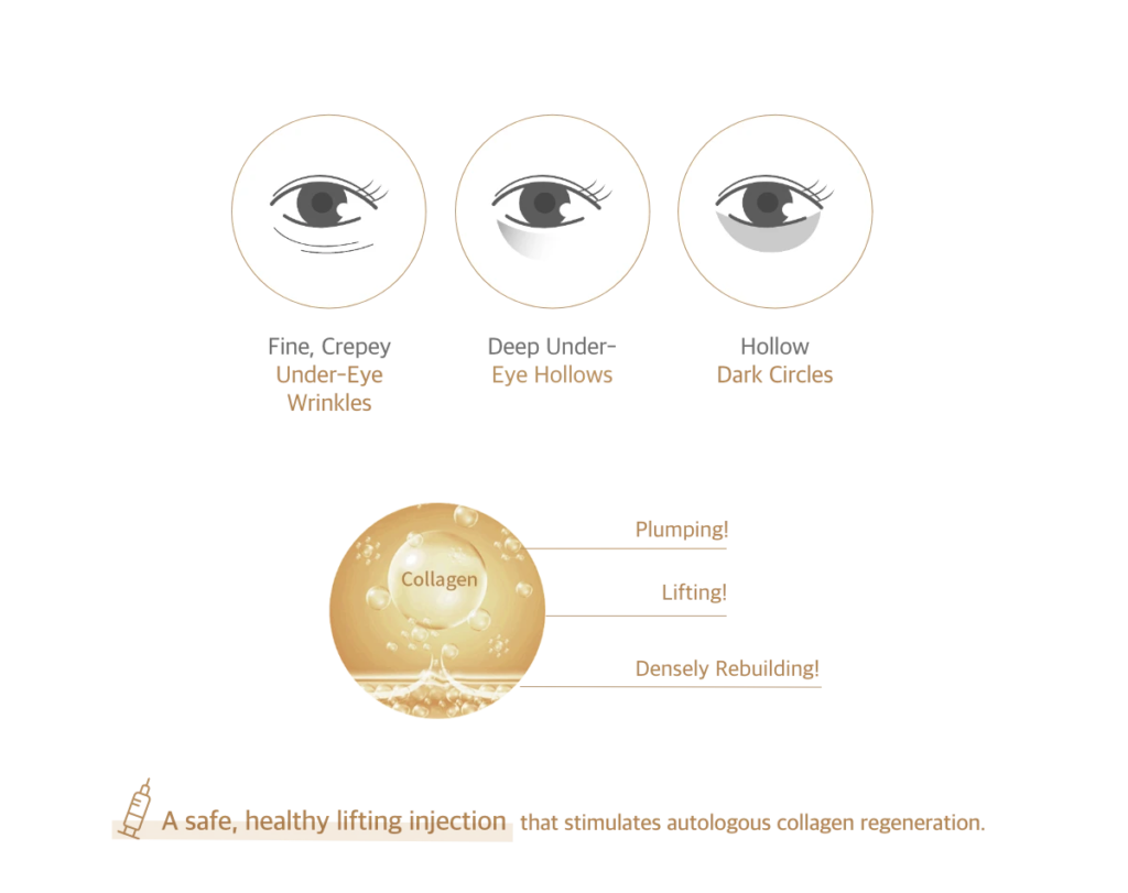 eyekong 1 – 1